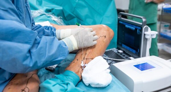 Cirujanos vasculares - Médico vascular realizando una cirugía de varices reconocido como uno de los mejores cirujanos vasculares en Valencia