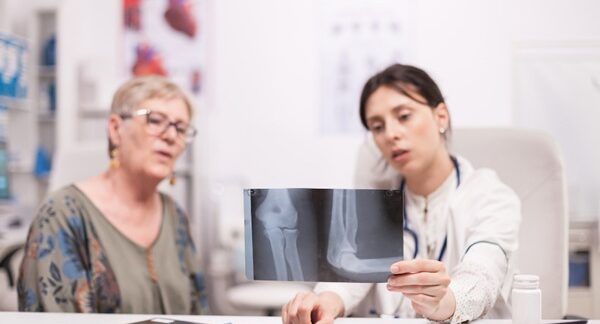 Osteoporosis - Médico especialista observando la radiografía de una mujer con fracturas debido a la pérdida de masa ósea en uno de los mejores centros de osteoporosis de Valencia